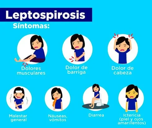 sr.leptospirosis1